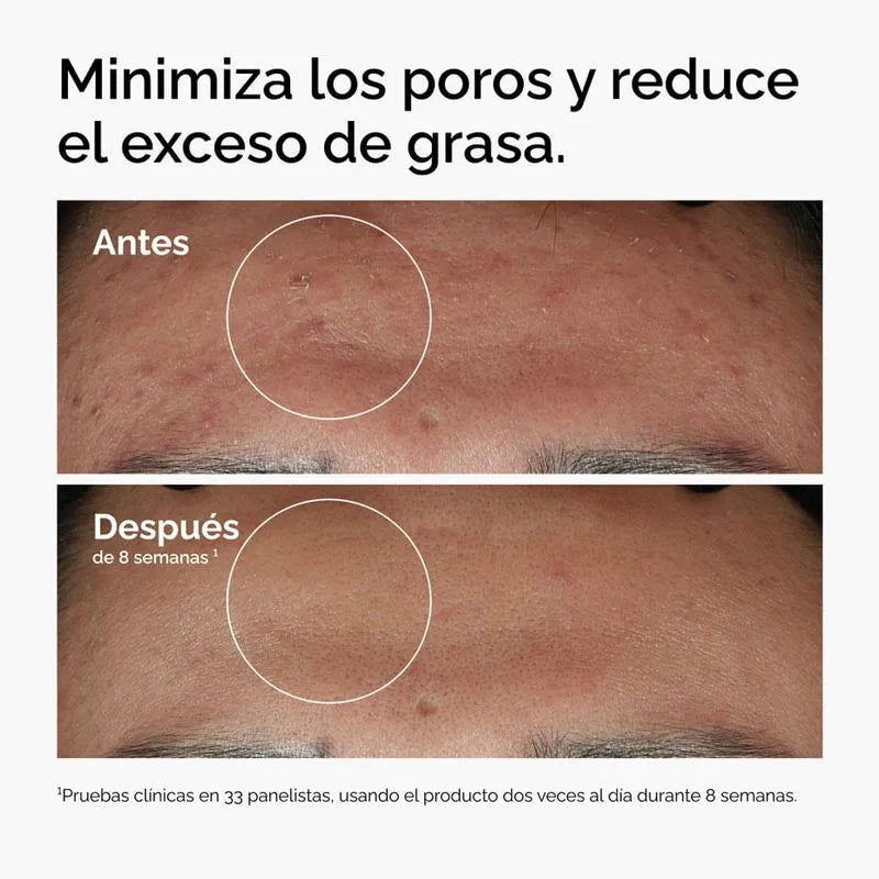 SUERO DE NIACINAMIDA NIACINAMIDE 10% + ZINC 1% - 30ML THE ORDINARY