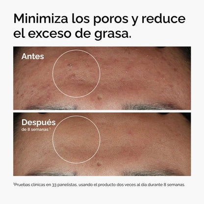 SUERO DE NIACINAMIDA NIACINAMIDE 10% + ZINC 1% - 30ML THE ORDINARY