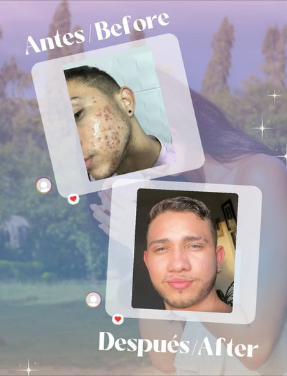 Jabón Arana